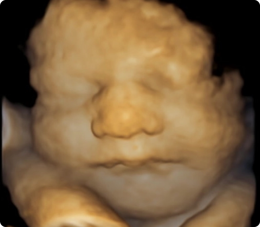 Jelly on my Belly Estudio de Ultrasonido 3D/4D/HD