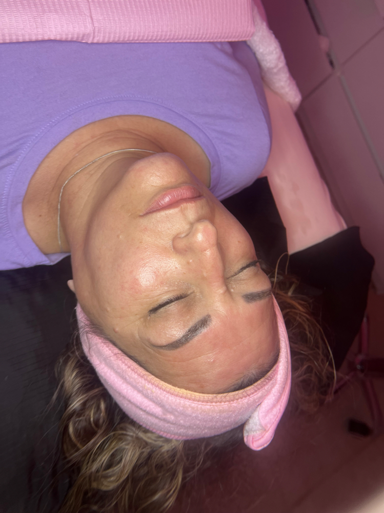 Skinbymireya