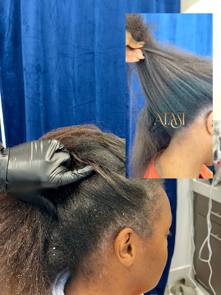 ATASI Head & Scalp Spa