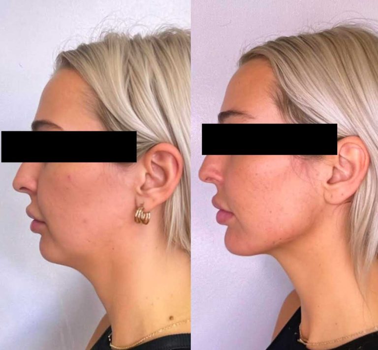 The Body Bar Medical Spa