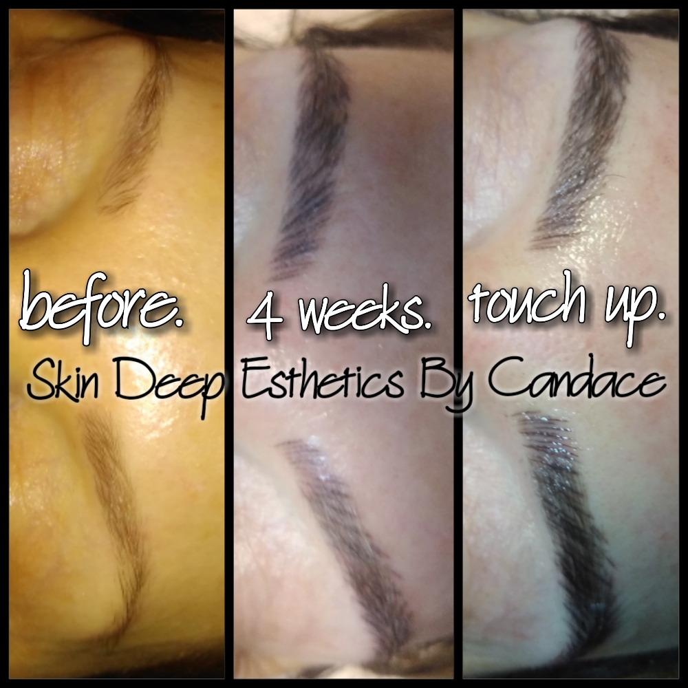 Skin Deep Esthetics de Candace