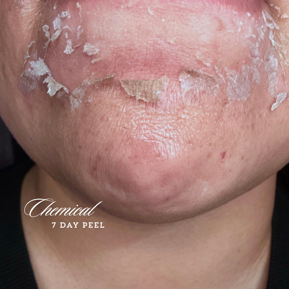 Brillo Etéreo | Terapias Ayurveda