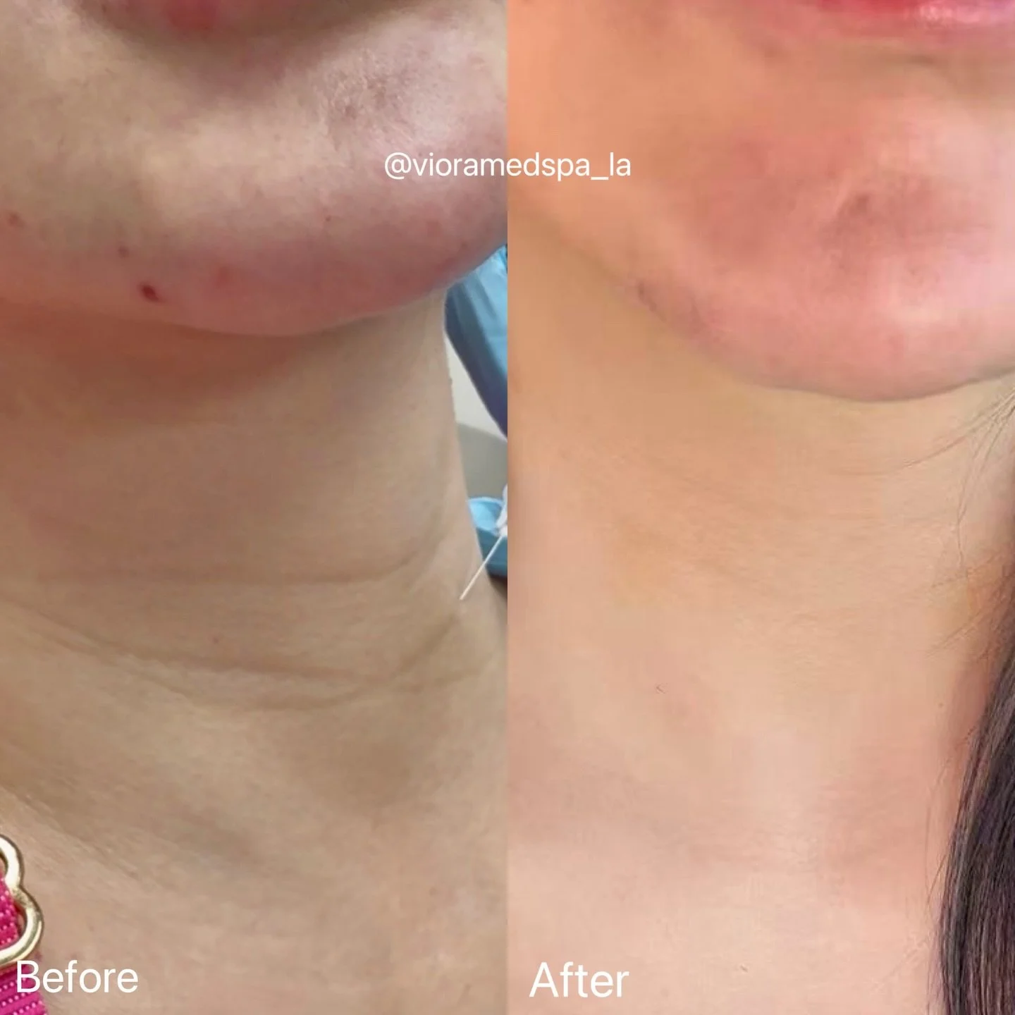 Viora MedSpa