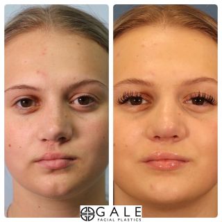 Gale Facial Plastics