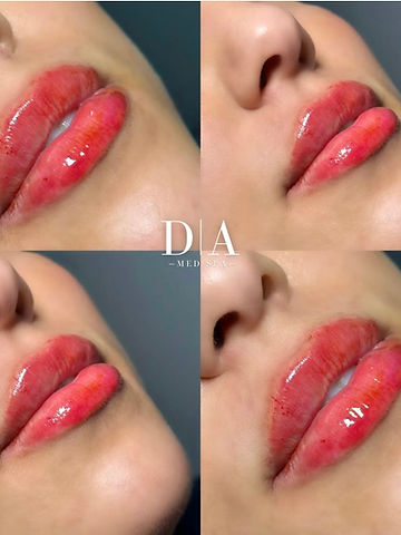 Derma Aesthetica Med Spa