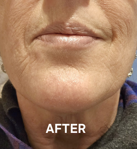 Foto de Park Slope Dermatology y Medi Spa
